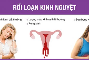 roi-loan-kinh-nguyet-va-nhung-dieu-nu-gioi-can-biet
