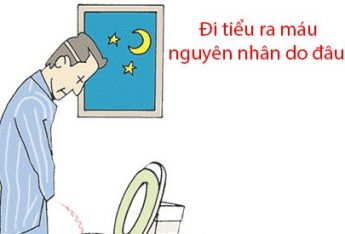 di-tieu-ra-mau-la-benh-gi