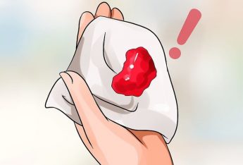 chay-mau-vung-kin-nam-nu-nguyen-nhan-cach-ho-tro-dieu-tri-tot-nhat