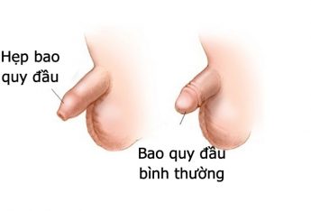 5-loi-ich-cua-hep-bao-quy-dau-nam-gioi-nhat-dinh-phai-biet