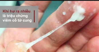 khi-hu-ra-nhieu-bat-thuong-do-dau-phai-lam-sao-moi-het