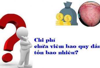chi-phi-chua-viem-bao-quy-dau