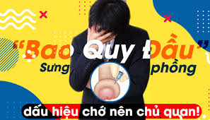 sung-bao-quy-dau-nguyen-nhan-do-dau