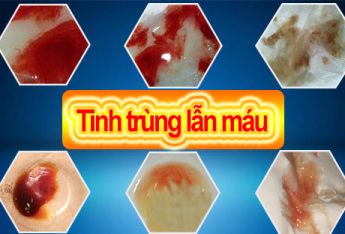 nguy-hiem-the-nao-khi-tinh-trung-co-mau