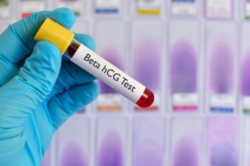 Chi phí xét nghiệm Beta HCG tại Hà Nội
